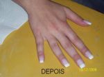 SILICONE FRANCESA